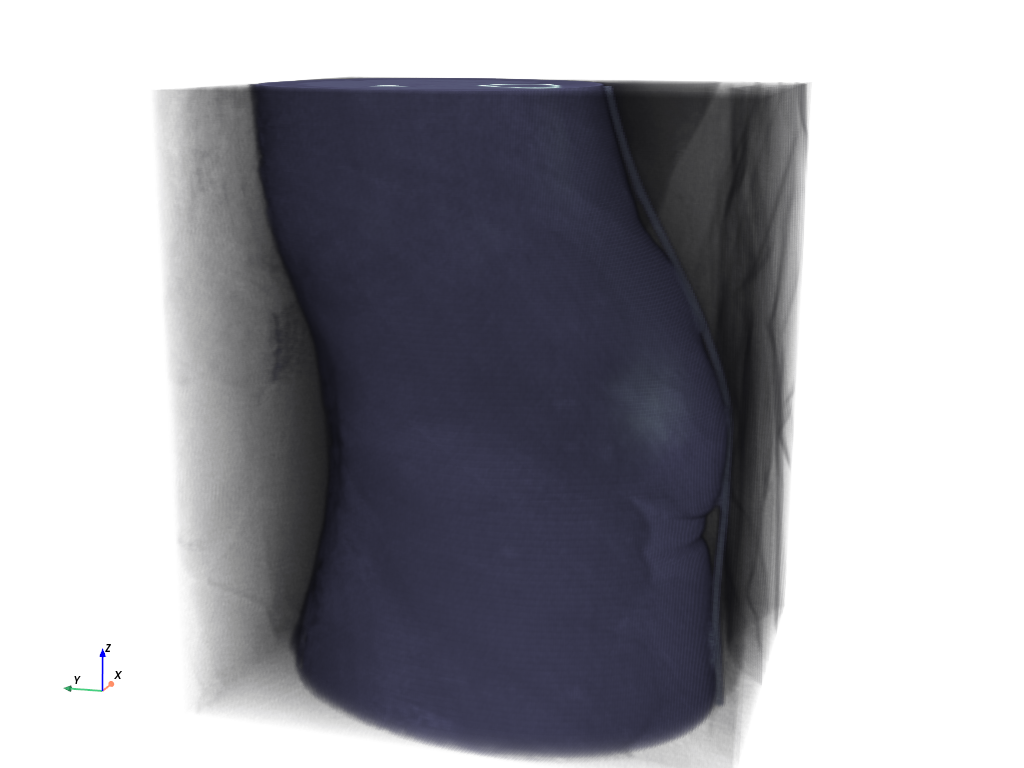 ../../_images/pyvista-examples-downloads-download_knee_full-331b1bc269bd639e_00_00.png