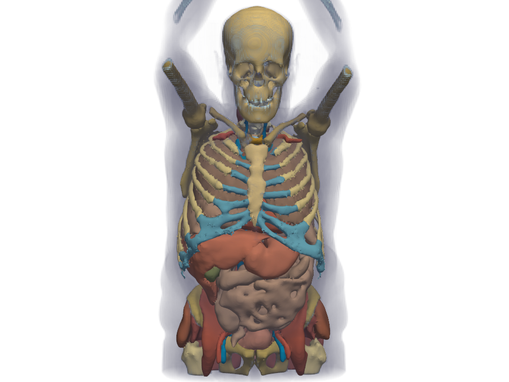../../_images/pyvista-examples-downloads-download_whole_body_ct_male-9511ada8603c5140_00_00.png
